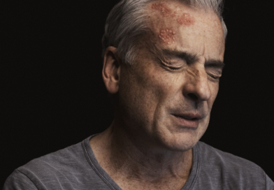 Los 7 mitos más comunes del Herpes Zóster