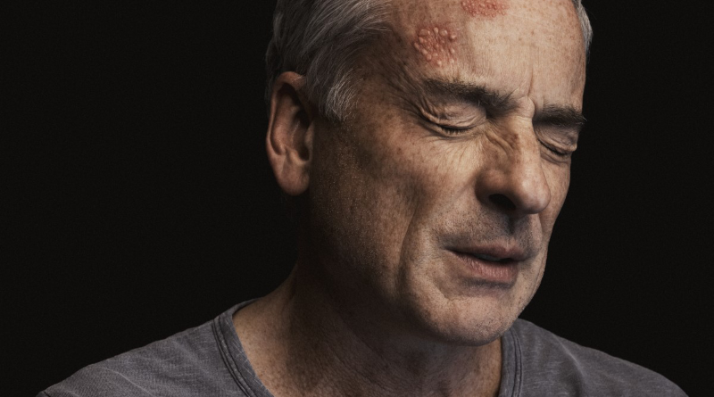 Los 7 mitos más comunes del Herpes Zóster