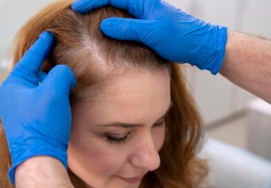 Recomendaciones prácticas para tratar la caída del cabello   