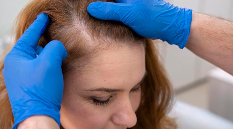 Recomendaciones prácticas para tratar la caída del cabello   