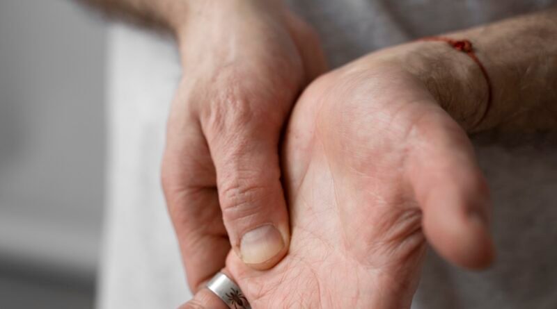 Cuando preocuparse por el entumecimiento y el hormigueo: Mayo Clinic explica la neuropatía y otras causas